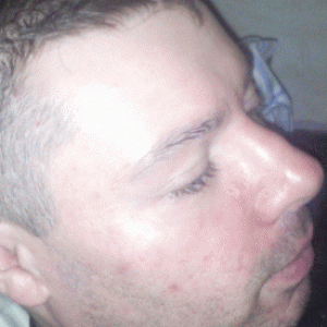 aerodiscutt 52 ans Saint Raphaël